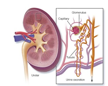 Чланци - Акутна бубрежна инсуфицијенција - симптоми, компликације и превенција