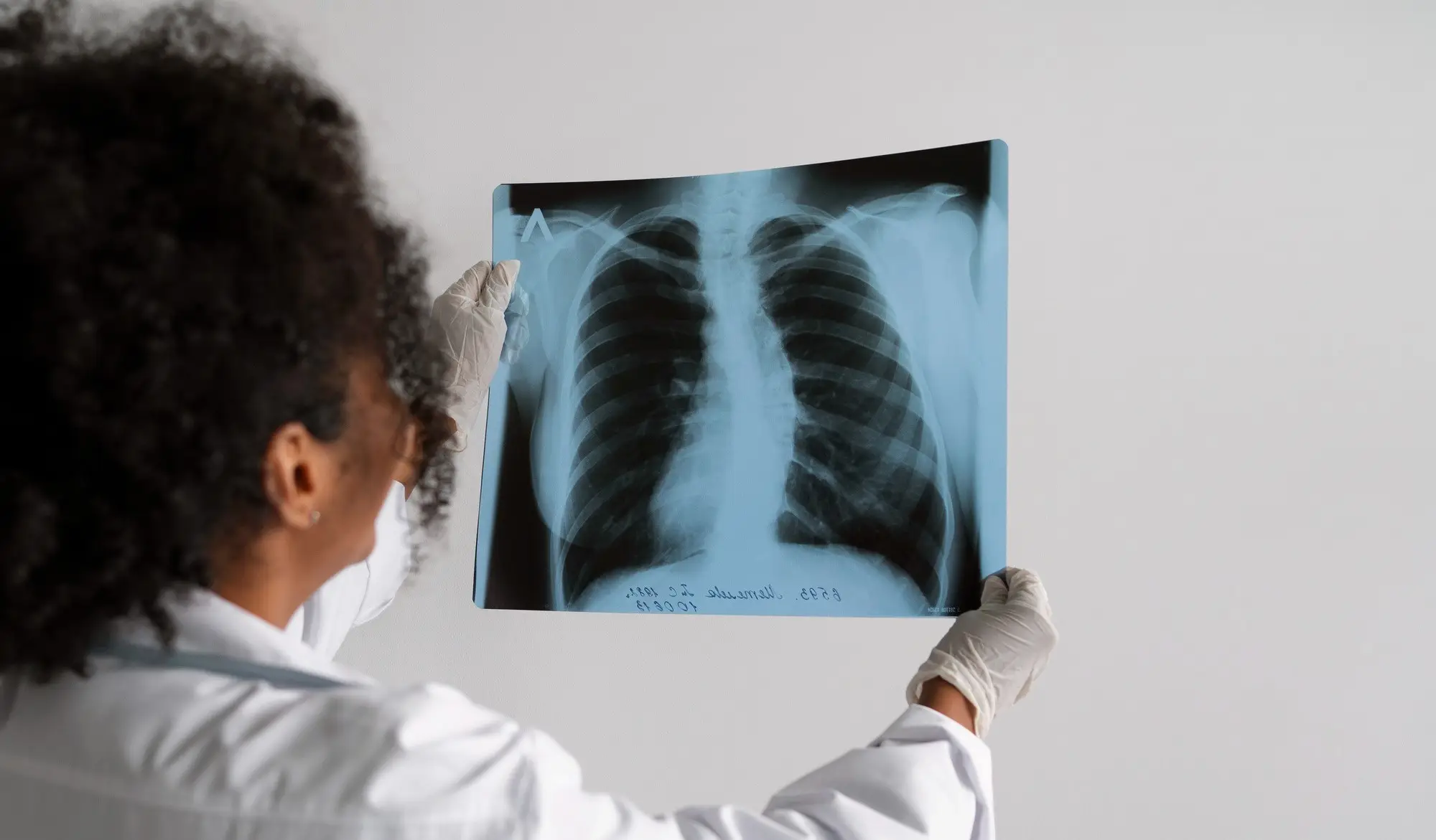 Articole - Cancerul pulmonar: care sunt primele simptome și cum să strângeți fonduri pentru tratament?